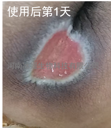 baaeae94-584a-441a-be9c-11b4e3859116.png