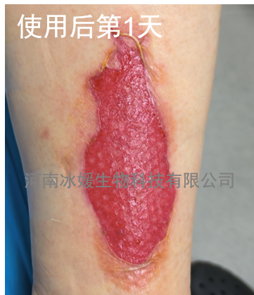 d45785cc-363d-40b4-b9d3-2c4c5d2d2bfd.png