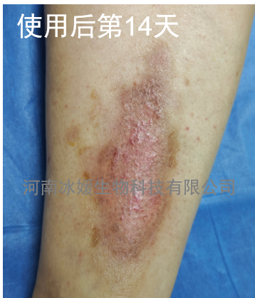 ed6c1456-85b2-4397-a197-a3361b6a1022.png