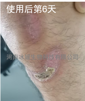 68acfacf-ec30-4b7f-9d33-9458e6a71329.png