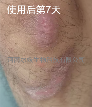 a315c3c2-9d3b-436a-ad5f-9263d7151f80.png
