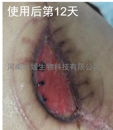 44ac79d4-4285-4c54-a329-680bac05f26a.png