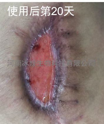 57ccc146-b2e6-4e70-9308-8bf78d226161.png