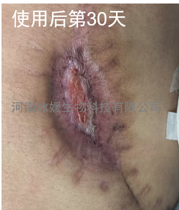 b9354798-eebf-4c91-990d-2390fcaf9ab0.png
