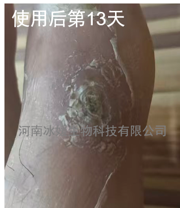 56f7f101-aeb5-4543-8c86-ecf4749d2363.png