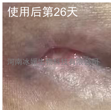 1f17e29b-a5aa-4a21-baa8-815b3bf572ca.png
