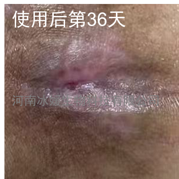 df960199-6c93-455c-b380-e5bafd210730.png