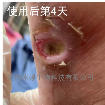 3acb3395-0a70-45d5-87af-c77b06abb71d.png