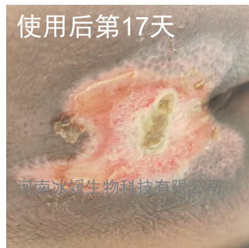 556f41d0-fbe5-402f-8eb1-2fda1bc9e7c9.png