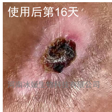 925976d9-0f13-4bb1-924f-1ce71d289189.png