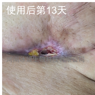 fddc62dc-a405-47a3-95b9-89d67587c782.png