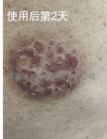 9397898a-71db-4661-9311-c1f090fe79cc.png