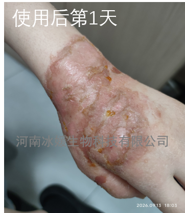 ab9b1bc3-0900-437f-a29c-3aa124a906bc.png