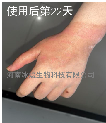 1b338dfb-7951-4823-9fc4-f31e068ee163.png